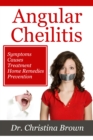 Image for Angular Cheilitis