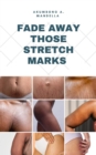 Image for FADE AWAY THOSE STRETCH MARKS: Are you tired of those ugly stretch marks on your body? Worry not because this ebook will give you all the step by step guide on fading them away.