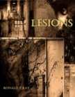 Image for Lesions