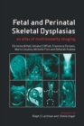 Image for Fetal and perinatal skeletal dysplasias: an atlas of multimodality imaging