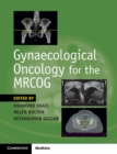 Image for Gynaecological Oncology for the MRCOG