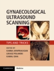 Image for Gynaecological ultrasound scanning  : tips and tricks