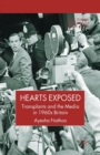 Image for Hearts Exposed : Transplants and the Media in 1960s Britain