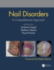 Image for Nail disorders: a comprehensive approach