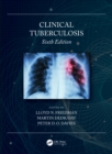 Image for Clinical Tuberculosis