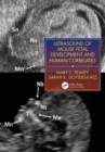 Image for Ultrasound of mouse fetal development and human correlates