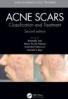 Image for Acne scars: classification and treatment