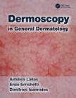 Image for Dermoscopy in general dermatology
