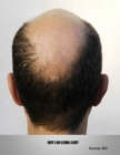 Image for Why I Am Losing Hair?