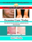 Image for Eczema Cure Today: Get Rid of Eczema Forever, Natural Ways to Cure Eczema