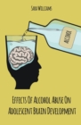 Image for Effects Of Alcohol Abuse On Adolescent Brain Development