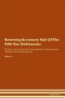 Image for Reversing Accessory Nail Of The Fifth Toe