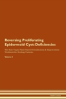 Image for Reversing Proliferating Epidermoid Cyst