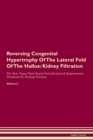 Image for Reversing Congenital Hypertrophy Of The Lateral Fold Of The Hallux