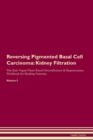 Image for Reversing Pigmented Basal Cell Carcinoma : Kidney Filtration The Raw Vegan Plant-Based Detoxification &amp; Regeneration Workbook for Healing Patients.Volume 5