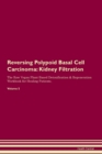 Image for Reversing Polypoid Basal Cell Carcinoma : Kidney Filtration The Raw Vegan Plant-Based Detoxification &amp; Regeneration Workbook for Healing Patients.Volume 5