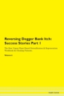 Image for Reversing Dogger Bank Itch