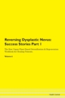 Image for Reversing Dysplastic Nevus : Success Stories Part 1 The Raw Vegan Plant-Based Detoxification &amp; Regeneration Workbook for Healing Patients. Volume 6
