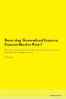 Image for Reversing Generalized Eczema : Success Stories Part 1 The Raw Vegan Plant-Based Detoxification &amp; Regeneration Workbook for Healing Patients. Volume 6