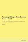 Image for Reversing Halogen Acne : Success Stories Part 2 The Raw Vegan Plant-Based Detoxification &amp; Regeneration Workbook for Healing Patients. Volume 7