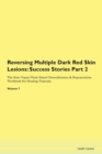 Image for Reversing Multiple Dark Red Skin Lesions : Success Stories Part 2 The Raw Vegan Plant-Based Detoxification &amp; Regeneration Workbook for Healing Patients. Volume 7