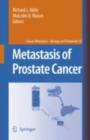 Image for Metastasis of Prostate Cancer : 10
