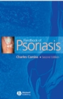 Image for Handbook of Psoriasis