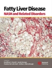 Image for Fatty liver disease  : NASH and related disorders
