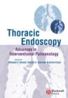 Image for Thoracic Endoscopy