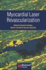 Image for Myocardial laser revascularization