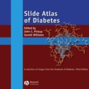 Image for Slide Atlas of Diabetes