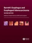Image for Barrett&#39;s Esophagus and Esophageal Adenocarcinoma