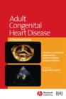 Image for Adult congenital heart disease: a practical guide
