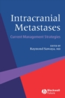 Image for Intracranial metastases: current management strategies