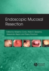 Image for Endoscopic Mucosal Resection