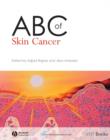 Image for ABC of Skin Cancer