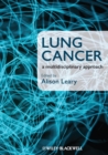 Image for Lung cancer  : a multidisciplinary approach