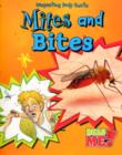 Image for Mites and Bites