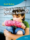 Image for What happens to broken bones?
