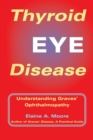 Image for Thyroid Eye Disease : Understanding Graves&#39; Opthalmopathy