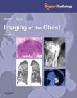 Image for Imaging of the Chest, 2-Volume Set
