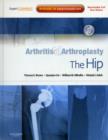 Image for Arthritis and Arthroplasty: The Hip