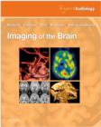 Image for Imaging of the Brain