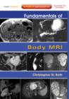 Image for Fundamentals of Body MRI