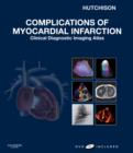 Image for Complications of Myocardial Infarction
