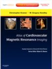 Image for Atlas of Cardiovascular Magnetic Resonance Imaging