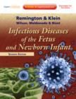 Image for Infectious Diseases of the Fetus and Newborn