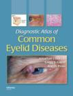 Image for Diagnostic atlas of common eyelid diseases