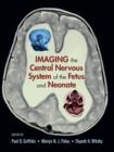 Image for Imaging the central nervous system of the fetus and neonate