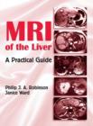Image for MRI of the liver: a practical guide